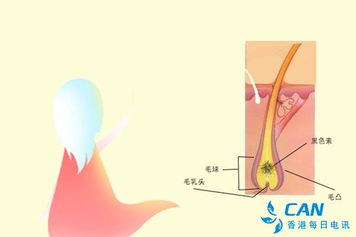 “少白头”是因为黑色素细胞提前合成减少吗？